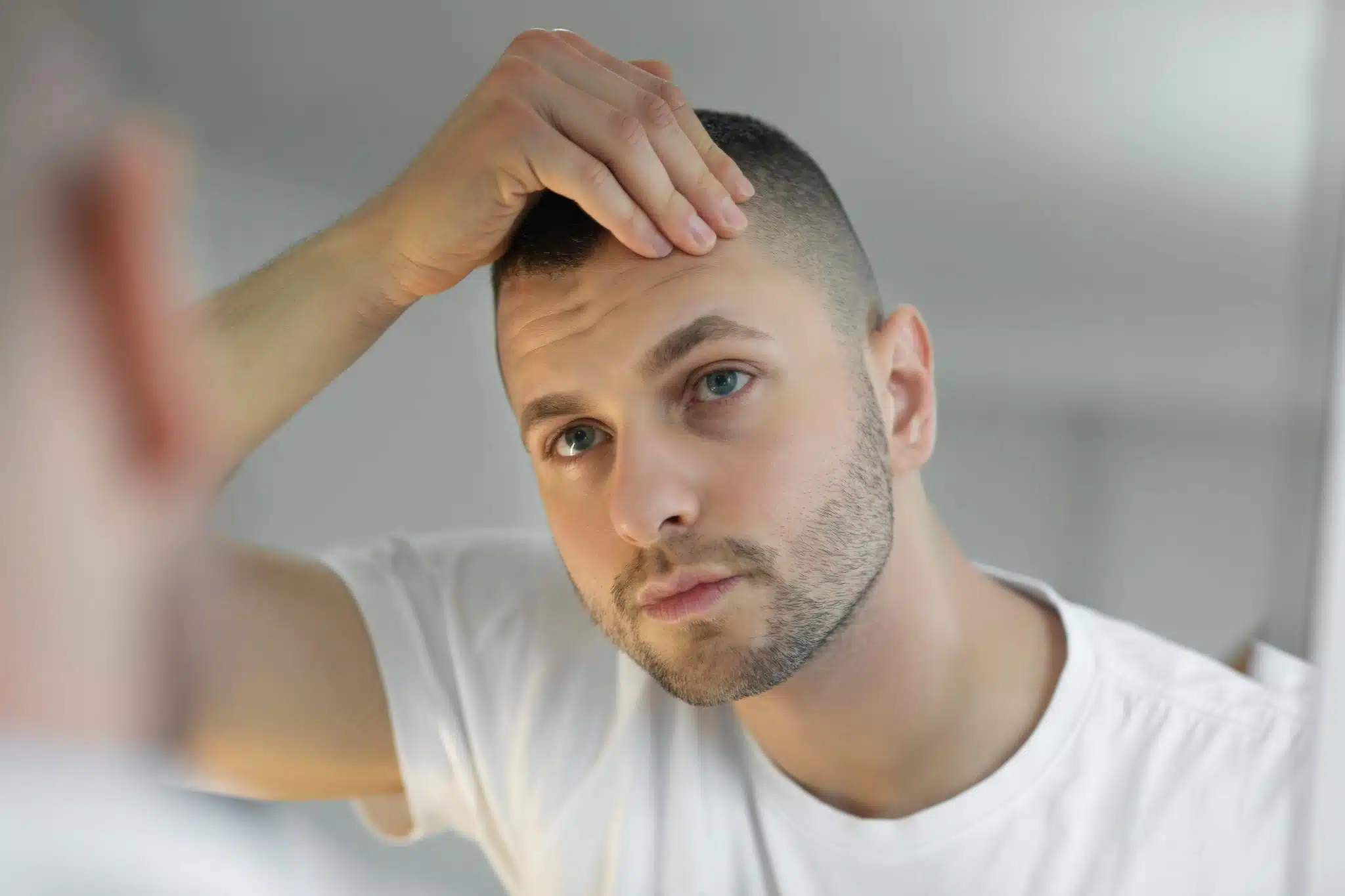 Qu'est-ce qu'une greffe de cheveux FUE ?